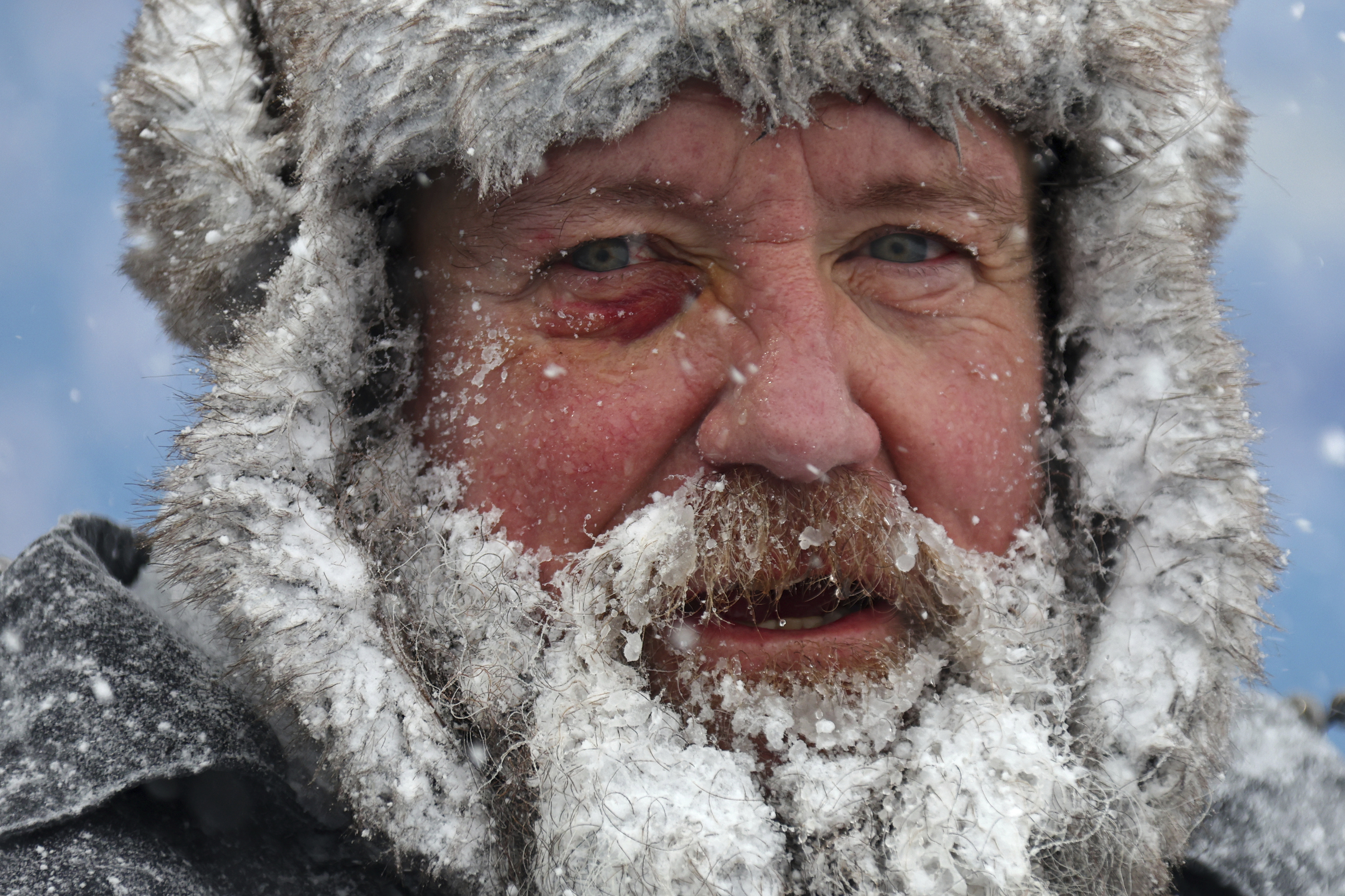 Extreme Cold Causes Misery Across US